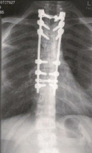 Chris saved his x-ray, it was so incredible.