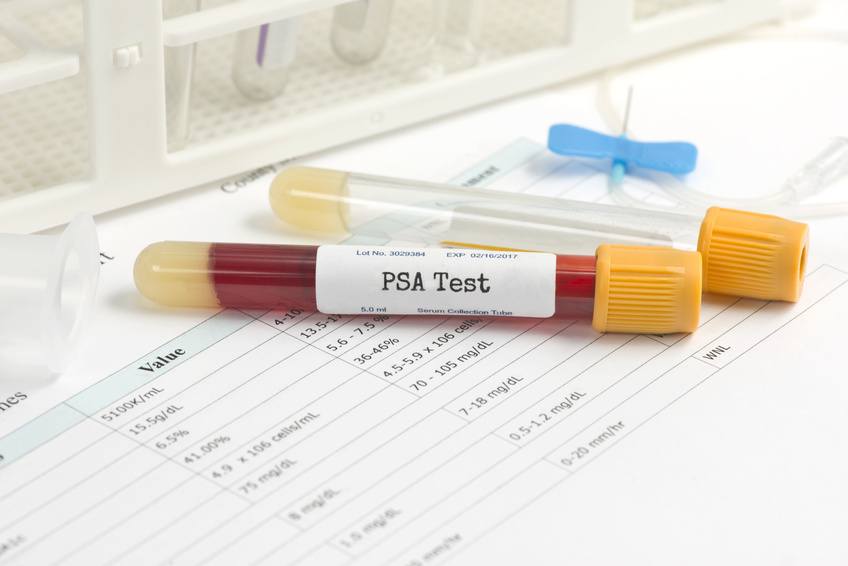 PSA analysis collection tube with blood collection supplies and report. Serial number is random, labels and document are fictitious and created by the photographer.